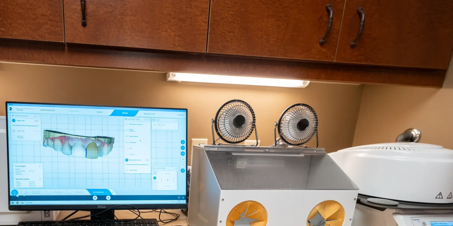 Digital scanning station and lab equipment at Redwood | Complete Smiles-Cottonwood Heights-Mountain View-Redwood-Utah